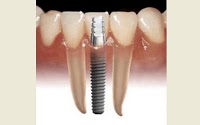 Advanced Dental Services 179623 Image 2