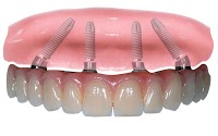 Centre for Aesthetic and Implant Dentistry 173522 Image 2