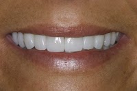 Cosmetic Dentistry Australia 170458 Image 9