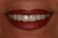 Dental 359 169351 Image 3