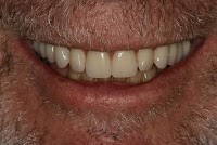 Dental 359 169351 Image 5