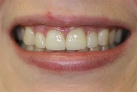 Dental On Clarendon 179910 Image 4