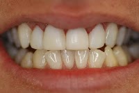 Dental On Clarendon 179910 Image 6