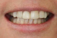 Dental On Clarendon 179910 Image 7