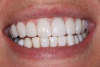 Dental On Clarendon 179910 Image 8