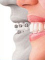 Holistic Dental and Implants dentistry 177860 Image 1