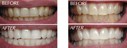 Pro Teeth Whitening (Aust) Pty. Ltd. 174343 Image 1