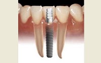 Advanced Dental Services 175333 Image 4