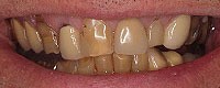 Artarmon Fine Dental 170276 Image 1