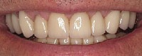 Artarmon Fine Dental 170276 Image 3