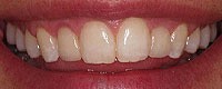 Artarmon Fine Dental 170276 Image 4