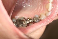 Belle Dental (Beautiful Smiles) Newcastle Dentist 175342 Image 1