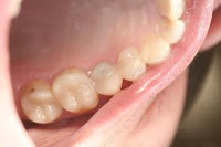 Belle Dental (Beautiful Smiles) Newcastle Dentist 175342 Image 2