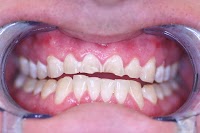 Belle Dental (Beautiful Smiles) Newcastle Dentist 175342 Image 3