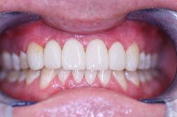 Belle Dental (Beautiful Smiles) Newcastle Dentist 175342 Image 4