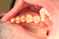 Belle Dental (Beautiful Smiles) Newcastle Dentist 175342 Image 6