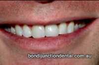 Bondi Junction Dental 178926 Image 5