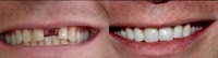 Bondi Junction Dental 178926 Image 9