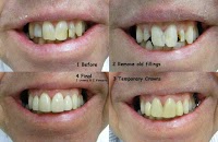 Bytes Dental 170347 Image 6