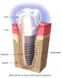 Centre for Aesthetic and Implant Dentistry 173522 Image 0