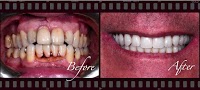 Centre for Aesthetic and Implant Dentistry 173522 Image 4