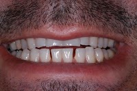 Chatswood Dental Associates 170936 Image 0