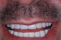 Chatswood Dental Associates 170936 Image 1