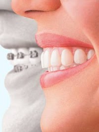 Class I Orthodontics 180468 Image 1