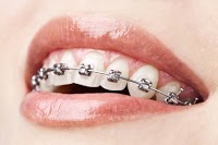 Class I Orthodontics 180468 Image 2