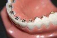 Clear Smiles Orthodontics 176050 Image 7