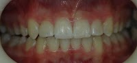 Cumberland Dental 171927 Image 4