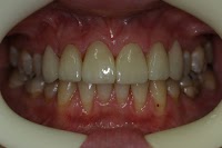Cumberland Dental 171927 Image 5