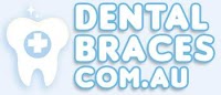 Dental Braces 181146 Image 0