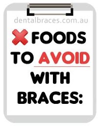 Dental Braces 181146 Image 4