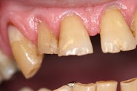 Dental Care Glebe 170290 Image 0