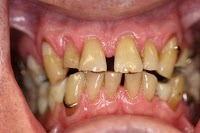 Dental Care Glebe 170290 Image 1