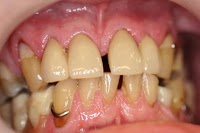Dental Care Glebe 170290 Image 3