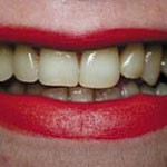 Dental Excellence   Perth Dentist 176220 Image 2