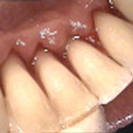 Dental Excellence   Perth Dentist 176220 Image 4