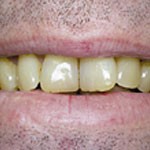 Dental Excellence   Perth Dentist 176220 Image 5
