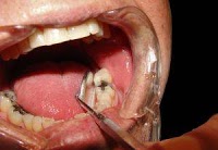 Dr. Veytsblit Dental 177899 Image 7