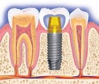 Edgecliff Fine Dental 175112 Image 3