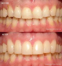 Floss Dental   Broadway Dentist 179547 Image 4