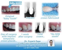 Gold Coast Dental Implants 170495 Image 1