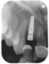 Institute for Dental Implants 177201 Image 3