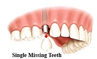Melbourne Fine Dentistry Mobile Site 180387 Image 7