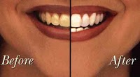 Multicare Dental 179693 Image 4
