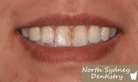 North Sydney Dentistry 174809 Image 3