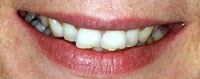 North Sydney Fine Dentistry   General and Cosmetic Dentists 177413 Image 3