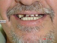 Robert Collins Dental Prosthetist 177379 Image 1